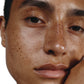 Close-up of a person's face with freckles on a white background